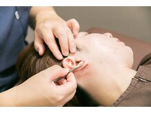 代官山アサ接骨院 鍼灸院(代官山 Asa 接骨院 鍼灸院)/耳つぼで不調にアプローチ/頭痛