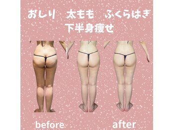 エアージーモ(Air Gmo)/下半身悩みも、解消！