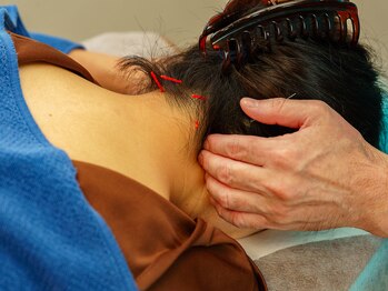 青空堂はりきゅうマッサージ院/首・肩こりの方に朗報!