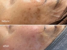 サロンリー(Salon Riee)