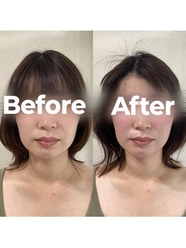 レオ(LEO)/Before→After