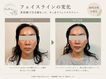 サロン ベラータ(Bellata)