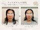 サロン ベラータ(Bellata)の写真