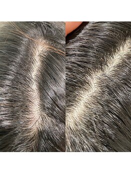 シュール センター南(SURREAL)/ヘッドスパ後のビフォーアフター