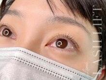 ロマ(Loma)/ラッシュリフト