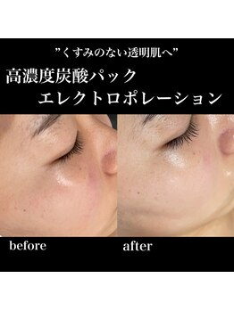 リブ(Lib)/目指すは水光肌♪