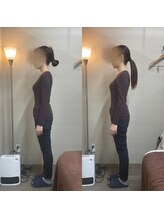 トラスト 錦糸町治療院/妊娠中期のお腹張り・呼吸の改善