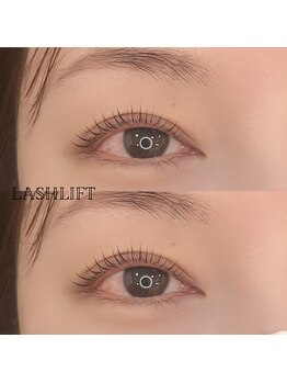 サラ(Sala)/ラッシュリフト(メーテルロッド)