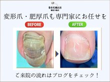 巻き爪補正店 鎌倉大船店の雰囲気（変形爪もお任せください♪ご来院の流れはブログをチェック！）