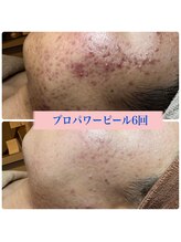 フェリーチェ(felice)/プロパワーピール