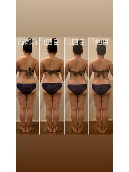 サロン クレスト(Salon Krest)/骨格調整＆リンパマッサージ