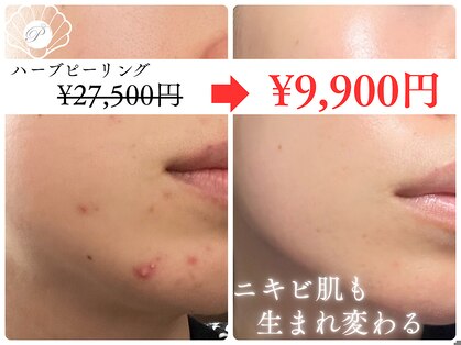 パールホワイトニングサロン 茅ヶ崎店の写真