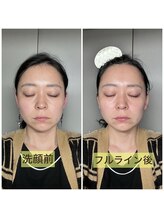 リリースパ 辻堂店(Lily spa)/韓国美容フェイシャルエステ