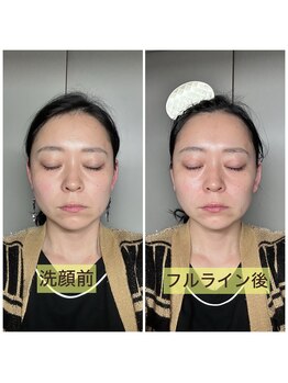 リリースパ 辻堂店(Lily spa)/韓国美容フェイシャルエステ