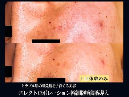 エヴァーグレース 栄店の写真