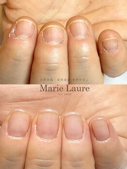 マリーロール 梅田店(Marie Laure)/自爪育成/深爪矯正/ネイルケア