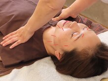 シフク鍼灸整体院/ハリ不足