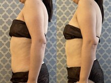 マイティー整骨院 ココア(CoCoa)/セルクラ