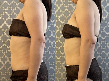 マイティー整骨院 ココア(CoCoa)/セルクラ