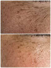 ギャラクシービューティー(galaxy beauty)/プラズマ×保湿