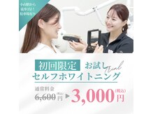ホワイトニングショップ 小山店