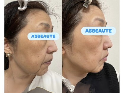 アスポーテ(ASBEAUTE)の写真