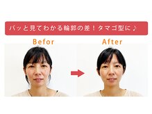 美容整体すこやか/BeforeーAfter