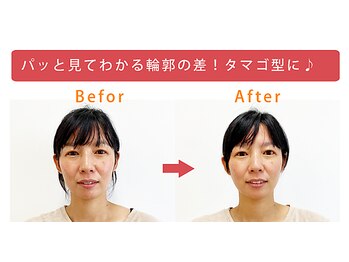 美容整体すこやか/BeforeーAfter