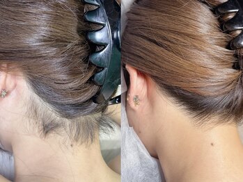 インベスト(INVEST)の写真/ここの部位だけ気になる...そんなお悩みも全て解決◎うなじ脱毛が人気♪キワまで丁寧に照射☆