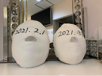 R-1ビューティーサロン 表参道/Before &After(6回)