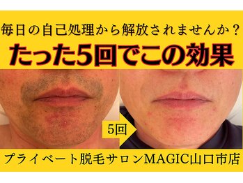 マジック 山口市店(MAGIC)/効果は２倍に価格は1/2に