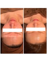 チェンジ 小山店(Change)/