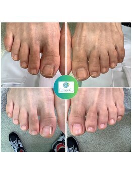 カリテス 富ヶ谷店(charites)/ ネイルキュアコース