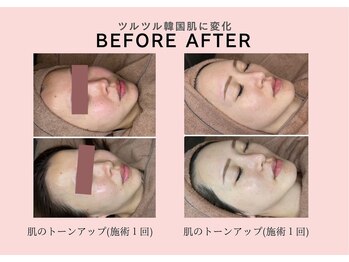 リジュベネーションサロン アリス(Alice)/ララピールB&A