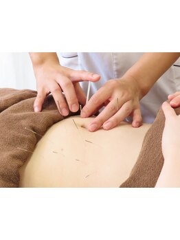 鍼灸施術を受けたい