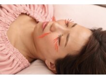 メイロン(meilong)/ポイント美容鍼