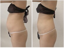 たった一回でしっかりと効果を実感いただけます。