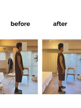 フィデル(fidele)/肩、背部、筋緊張と姿勢改善例