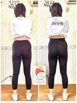 ピーチ鍼灸整体治療院(Peach鍼灸整体治療院)/