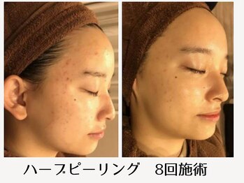 フアリト 江坂店(Fuari-to)/Before After9