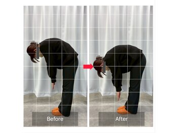 ナオル整体 山形院(NAORU整体)/Before→After【30代/女性】