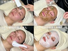 大人気ハーブピーリングやハイドラ毛穴洗浄、幹細胞導入で施術♪