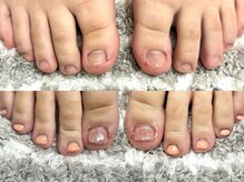 グラシナ なんば店/深爪/自爪育成/フィルイン