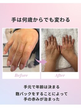 フルールスレーヌ(Fleur Sereine)/ハンドケア