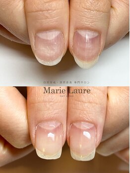 マリーロール 梅田店(Marie Laure)/自爪育成/深爪矯正/ネイルケア