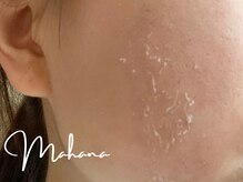 マハナ(mahana)