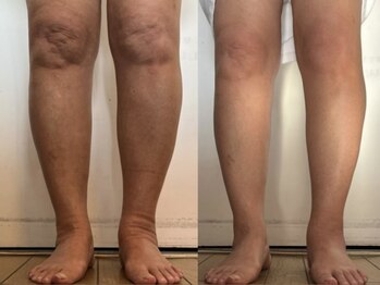ソワン アーリア(Soin Arya)の写真/足のむくみにアプローチ！足の疲れや冷えも解消！美脚になりたい方にオススメ♪お気軽にご相談下さい♪