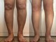 ソワン アーリア(Soin Arya)の写真/足のむくみにアプローチ！足の疲れや冷えも解消！美脚になりたい方にオススメ♪お気軽にご相談下さい♪