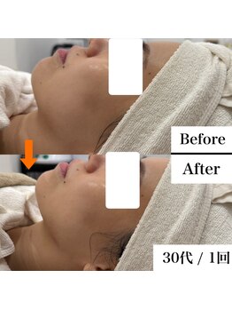 グラシア 宇土店(gracia)/