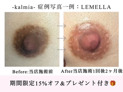 カルミア(kalmia)の写真